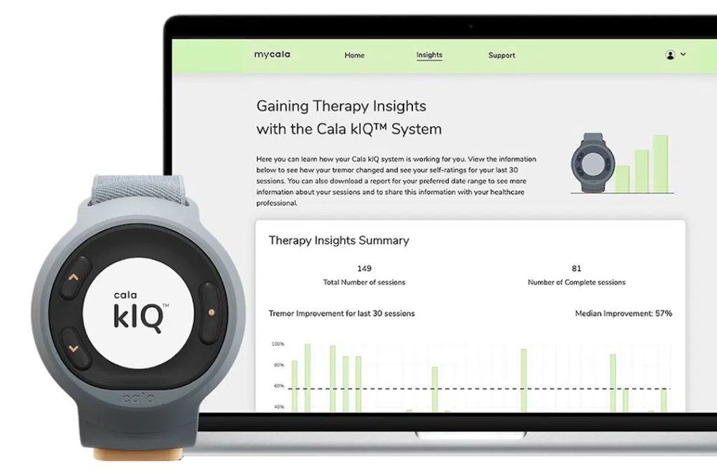 The Cala kIQ is a wearable tech device home screen showing health metrics.